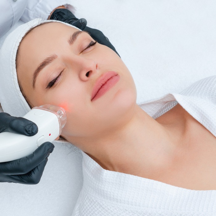 beautiful woman getting laser acne treatment