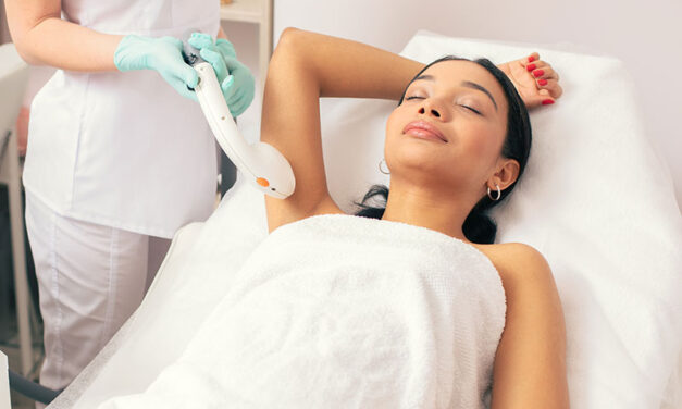 5 Reasons to Choose Laser Hair Removal Over Waxing or Shaving